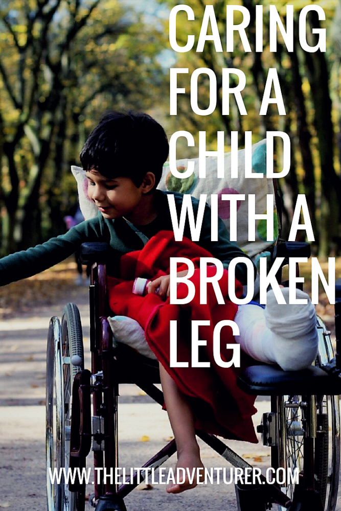 Caring for a child with a broken leg - ideas for helpful equipment, books, and gifts, as well as activities and trips out - The Little Adventurer