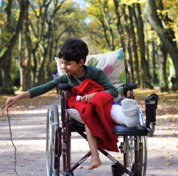 Ideas for caring for a child with a broken leg - The Little Adventurer